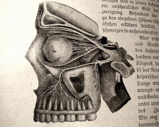 Antique Erotic German Medical Book Historic 1914 Incredible